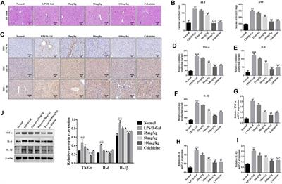 Puerarin Prevents Acute Liver Injury via Inhibiting Inflammatory Responses and ZEB2 Expression